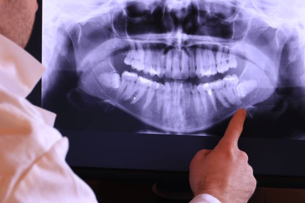 Best Emergency Broken Tooth Repair in Osceola, AR